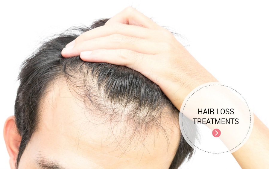 hair loss treatment