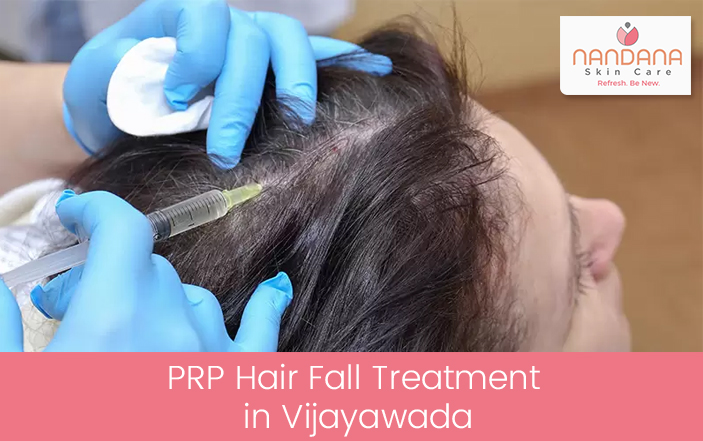 PRP Hair Fall Treatment in Vijayawada - Nandana Skin Care, VIjayawada PRP Hair Fall Treatment in Vijayawada - Nandana Skin Care, VIjayawada